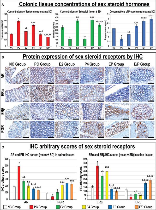 Progesterone Receptor Antibody in Immunohistochemistry (IHC)