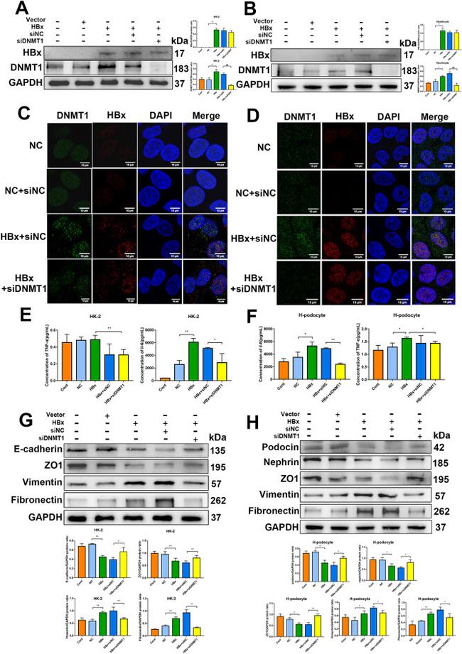 Hepatitis B Virus X Antibody in Immunocytochemistry (ICC/IF)