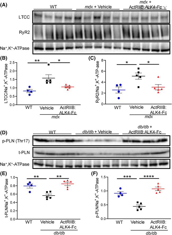 Phospholamban Antibody in Western Blot (WB)