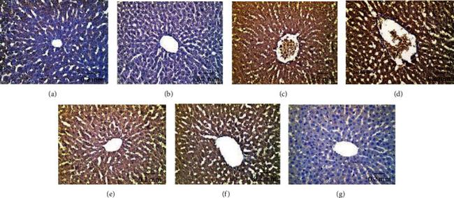 p53 Antibody in Immunohistochemistry (IHC)