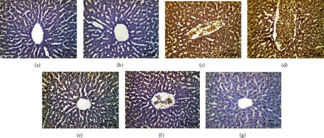 TNF alpha Antibody in Immunohistochemistry (IHC)