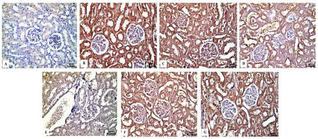 Bcl-2 Antibody in Immunohistochemistry (IHC)