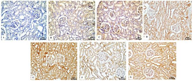 p53 Antibody in Immunohistochemistry (IHC)