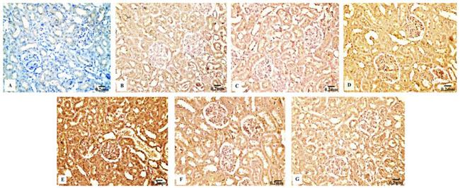 TNF alpha Antibody in Immunohistochemistry (IHC)