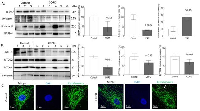 Fibronectin Antibody in Western Blot (WB)