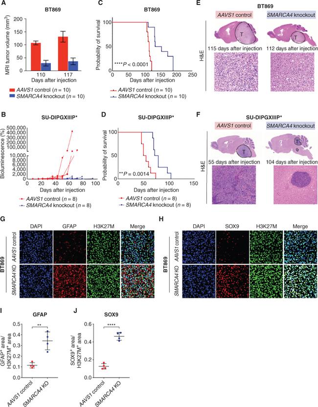 GFAP Antibody in Immunohistochemistry (IHC)