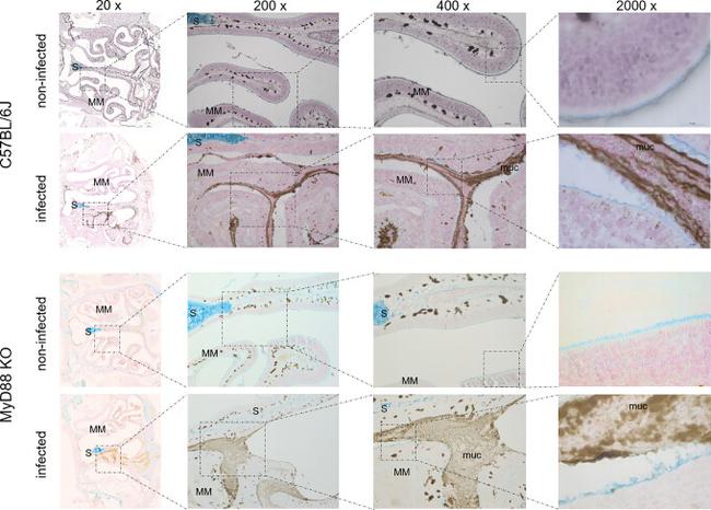 MUC5AC Antibody in Immunohistochemistry (IHC)