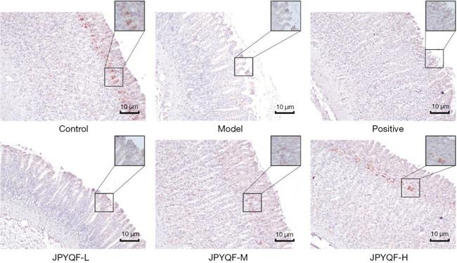 MUC5AC Antibody in Immunohistochemistry (IHC)