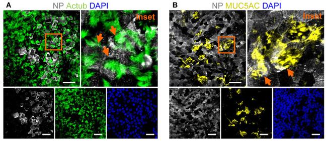 MUC5AC Antibody in Immunocytochemistry (ICC/IF)