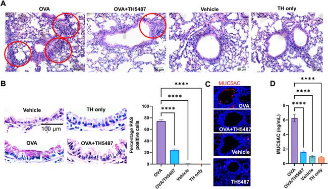 MUC5AC Antibody in Immunohistochemistry (IHC)