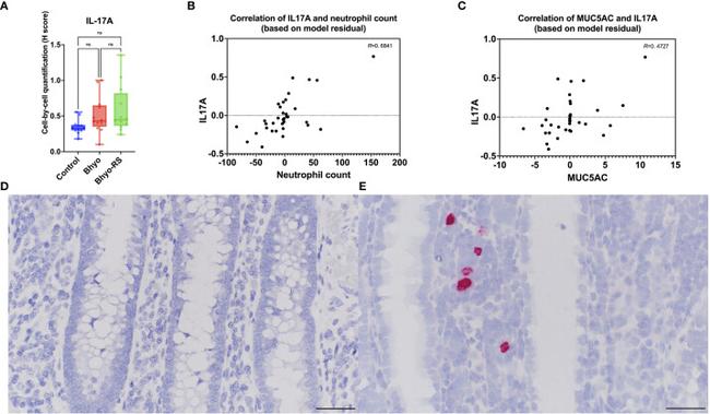 MUC5AC Antibody in Immunohistochemistry (IHC)