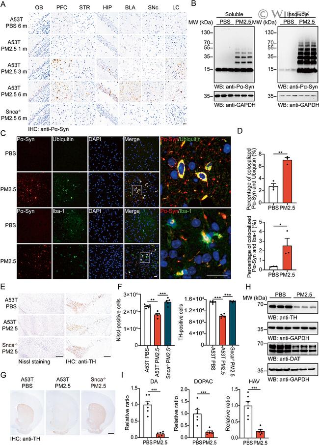 alpha Synuclein Antibody in Immunohistochemistry (IHC)