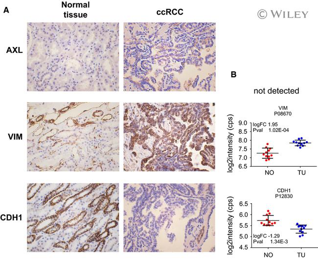 E-cadherin Antibody in Immunohistochemistry (IHC)