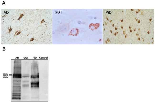 Tau Antibody in Western Blot (WB)