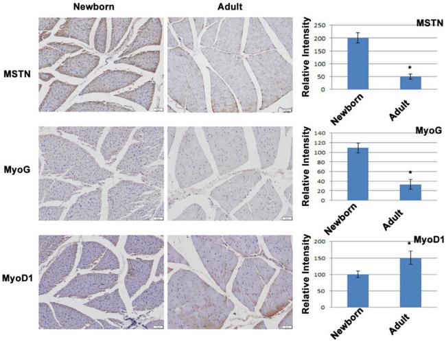 MYOD Antibody in Immunohistochemistry (IHC)