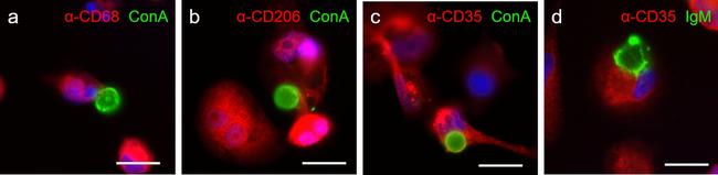 CD35 Antibody in Immunocytochemistry (ICC/IF)