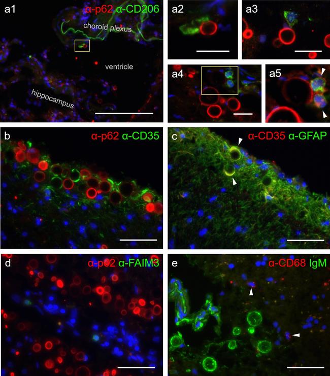 CD35 Antibody in Immunohistochemistry (IHC)