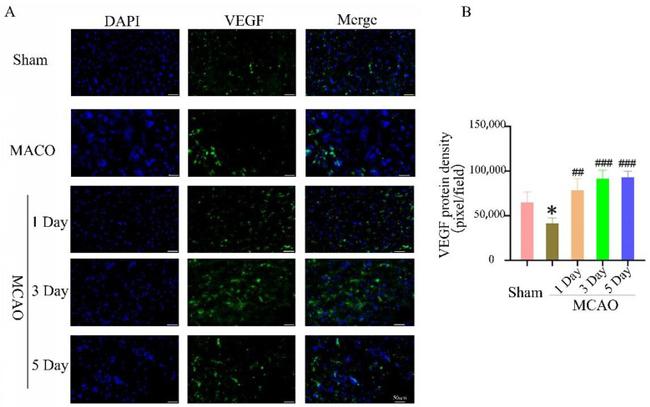 VEGF Antibody in Immunohistochemistry (IHC)