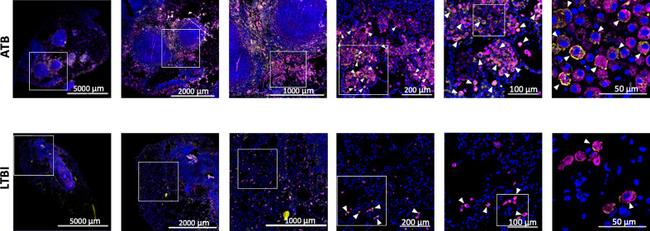 CD68 Antibody in Immunohistochemistry (IHC)