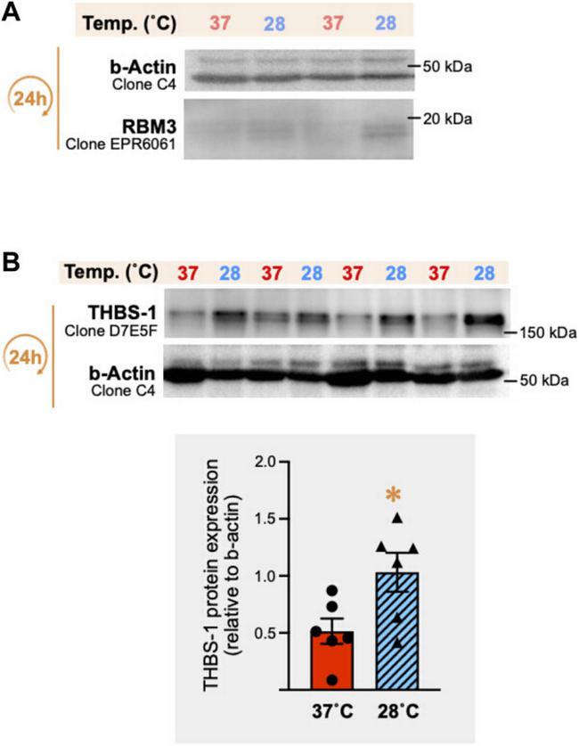 Thrombospondin 1 Antibody in Western Blot (WB)