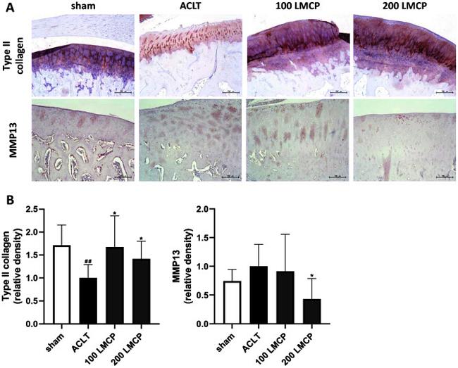 MMP13 Antibody in Immunohistochemistry (IHC)