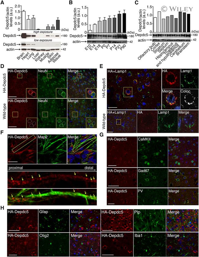 GFAP Antibody in Immunohistochemistry (IHC)