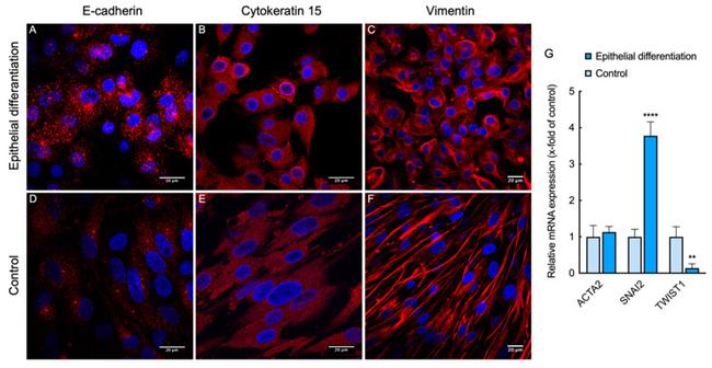 Cytokeratin 15 Antibody in Immunocytochemistry (ICC/IF)