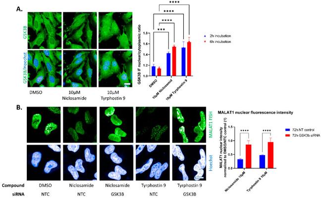 GSK3B Antibody in Immunocytochemistry (ICC/IF)