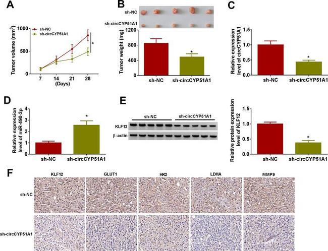 MMP9 Antibody in Immunohistochemistry (IHC)