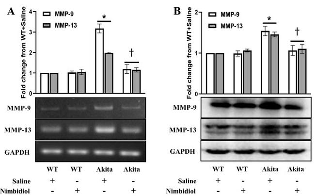 MMP9 Antibody in Western Blot (WB)