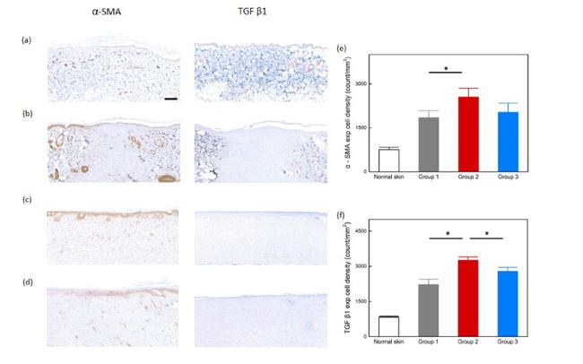 TGF beta-1 Antibody in Immunohistochemistry (IHC)