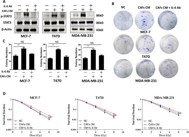 IL-6 Antibody in Neutralization (Neu)