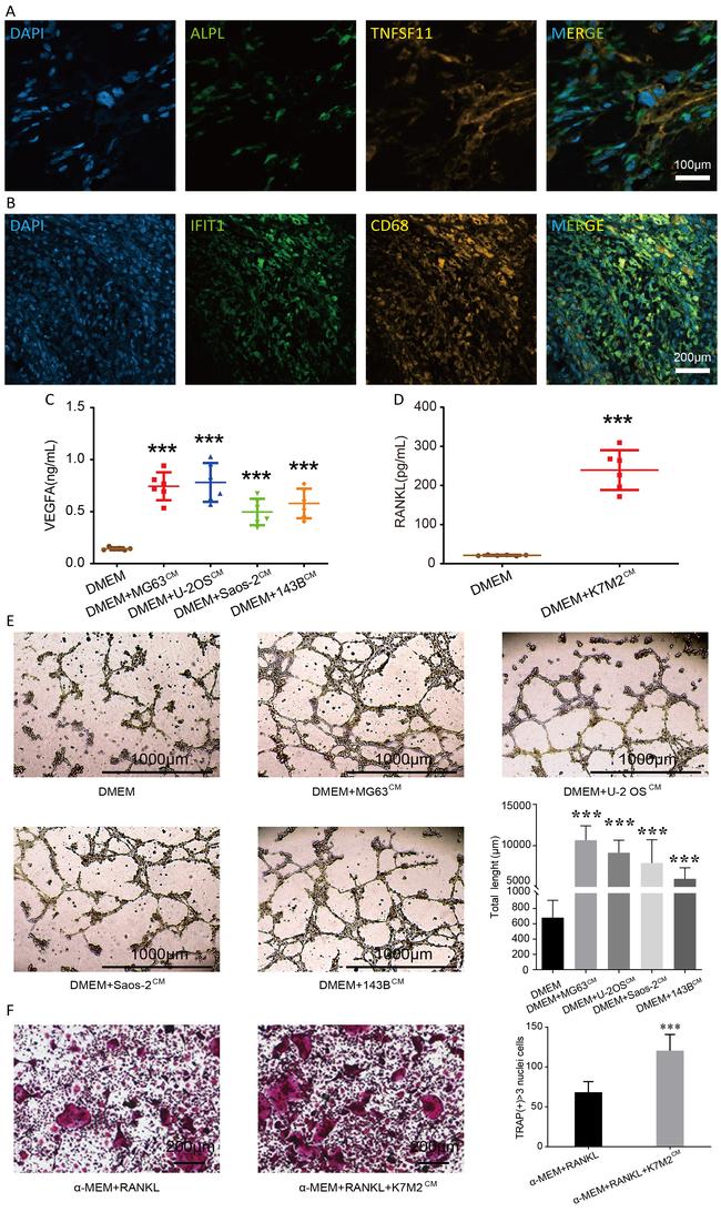 ALPL Antibody in Immunohistochemistry (IHC)