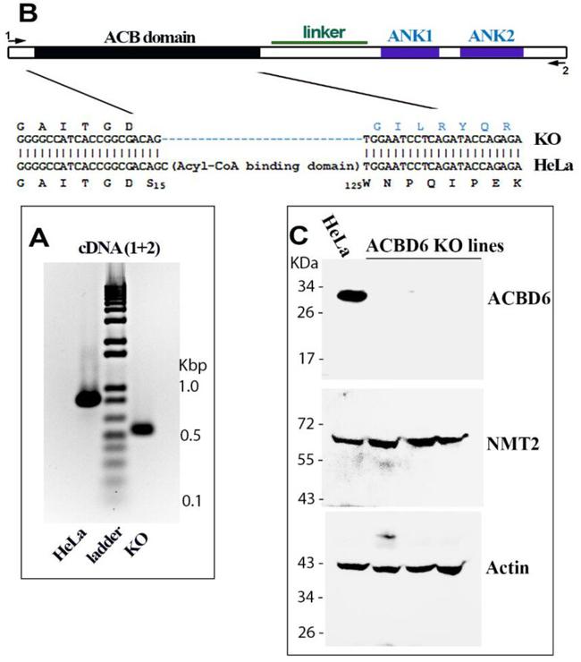 ACBD6 Antibody in Western Blot (WB)