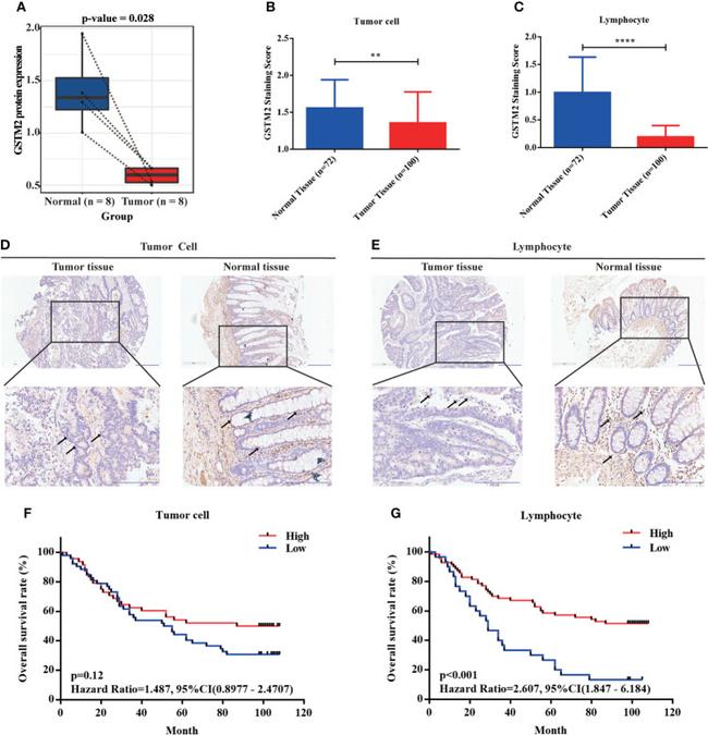 GSTM2 Antibody in Immunohistochemistry (IHC)