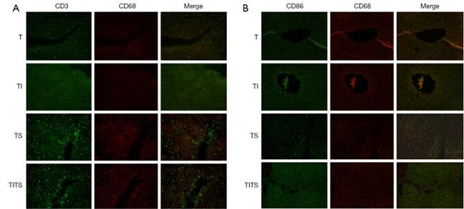 CD86 (B7-2) Antibody in Immunohistochemistry (IHC)