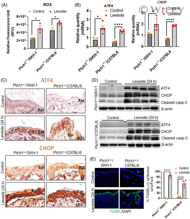 ATF4 Antibody in Immunohistochemistry (IHC)