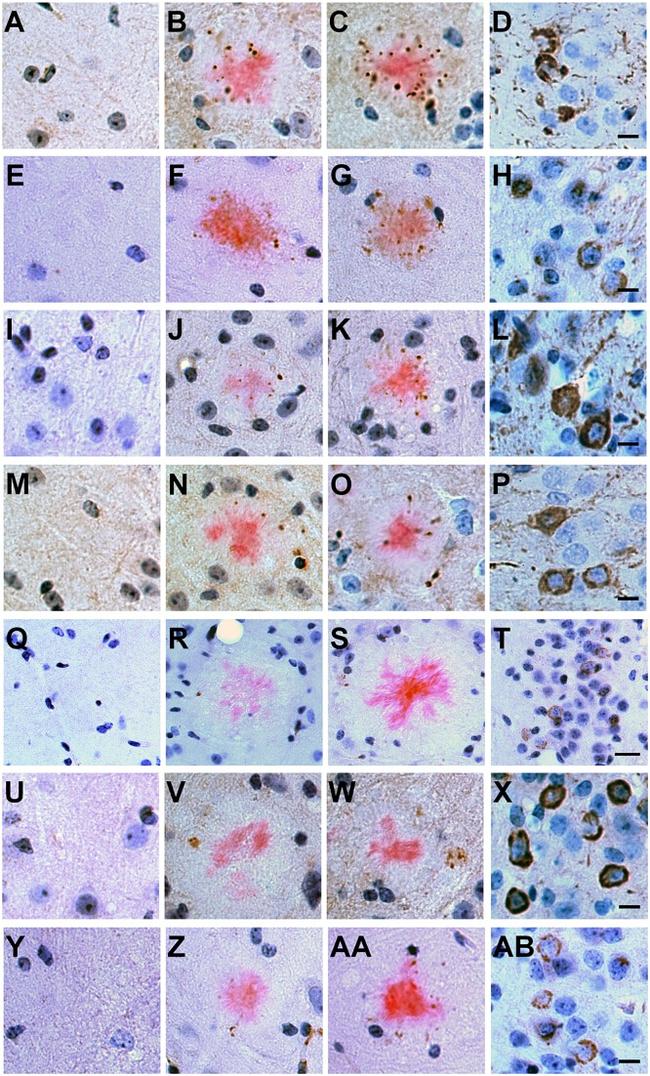 Phospho-Tau (Ser202, Thr205) Antibody in Immunohistochemistry (IHC)