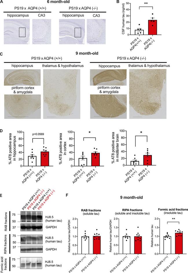 Phospho-Tau (Ser202, Thr205) Antibody in Immunohistochemistry (IHC)