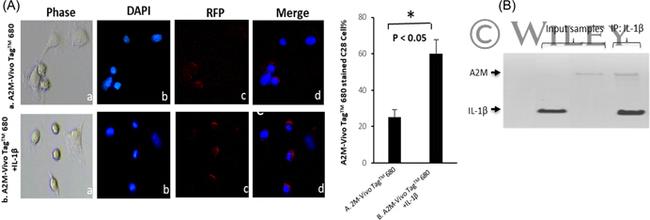 IL-1 beta Antibody in Immunoprecipitation (IP)