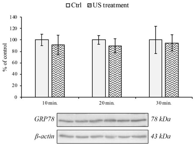 GRP78 Antibody in Western Blot (WB)