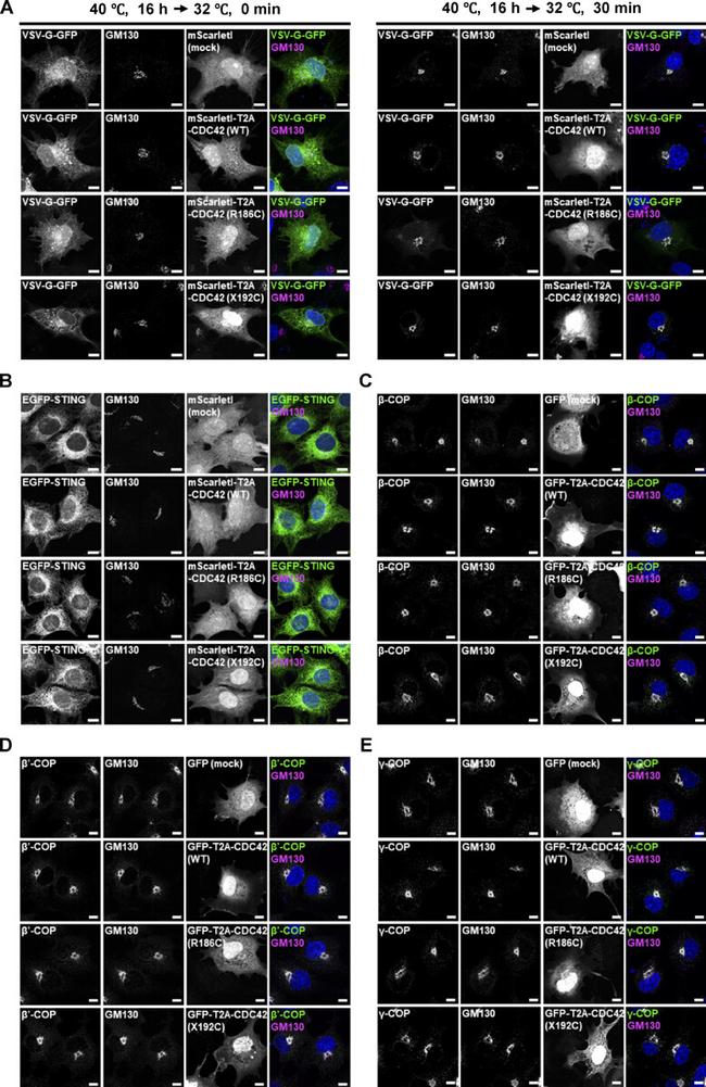 beta COP Antibody in Immunocytochemistry (ICC/IF)