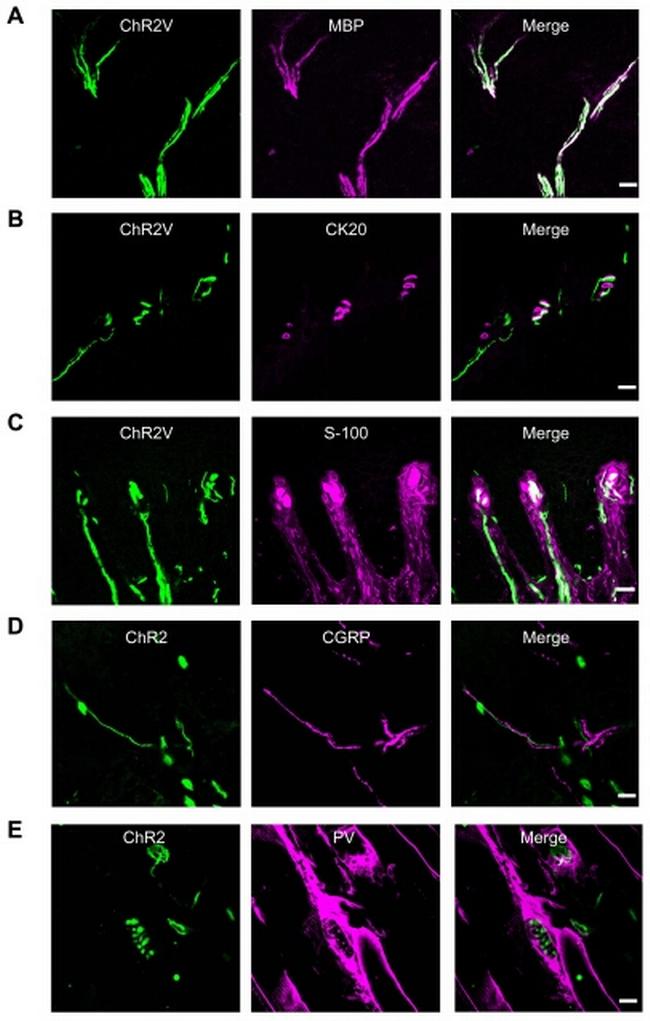 MBP Antibody in Immunohistochemistry (IHC)