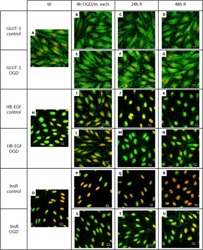 GLUT1 Antibody in Immunocytochemistry (ICC/IF)