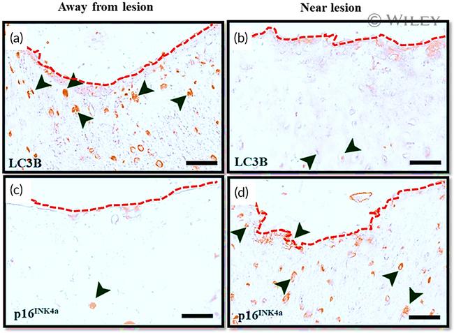 LC3B Antibody in Immunohistochemistry (IHC)