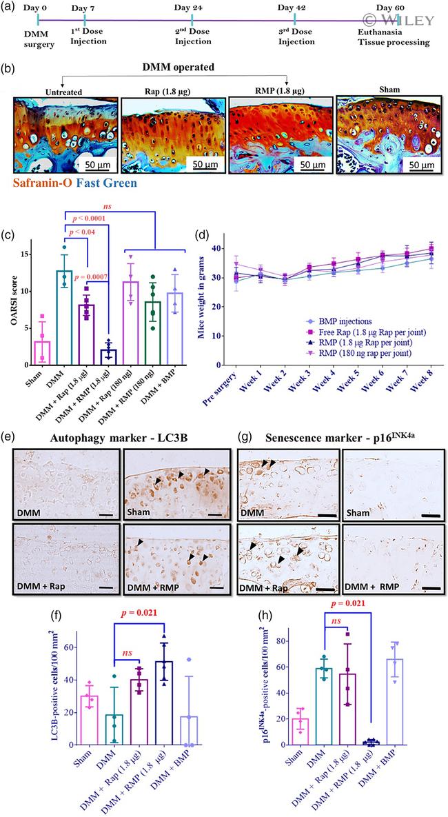 LC3B Antibody in Immunohistochemistry (IHC)