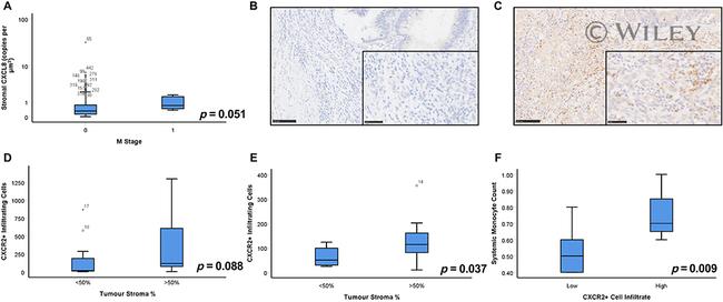 CXCR2 Antibody in Immunohistochemistry (IHC)