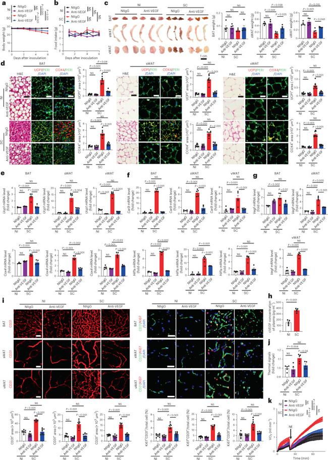 UCP1 Antibody in Immunohistochemistry (IHC)