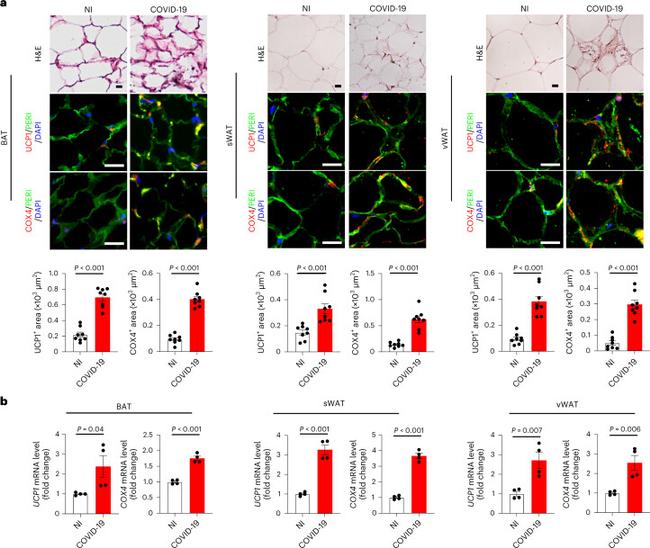 UCP1 Antibody in Immunohistochemistry (IHC)