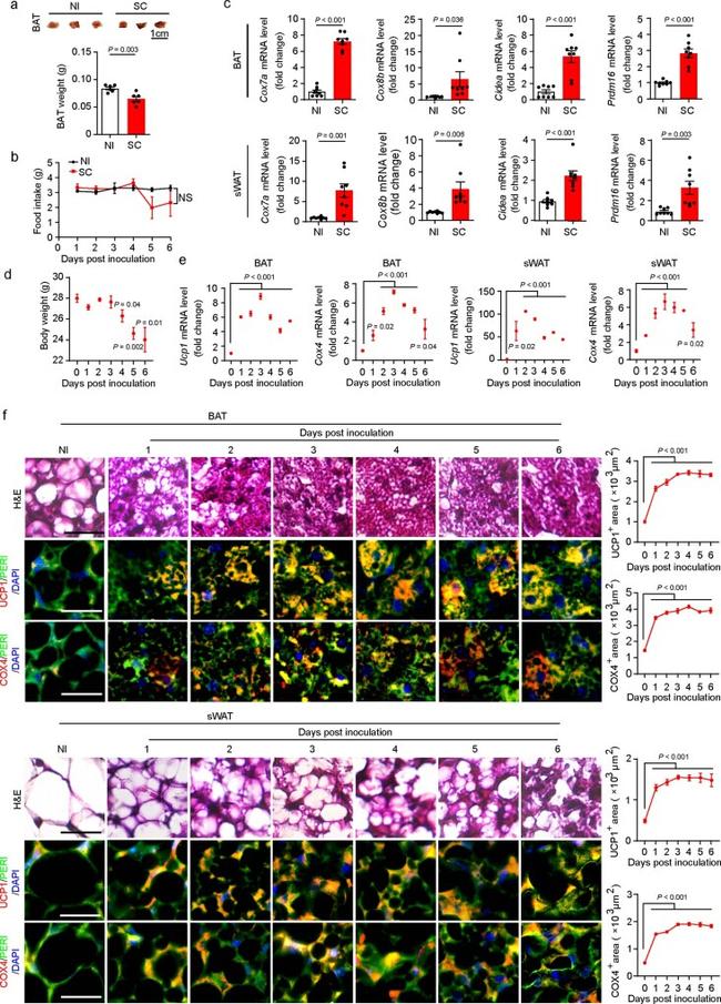 UCP1 Antibody in Immunohistochemistry (IHC)